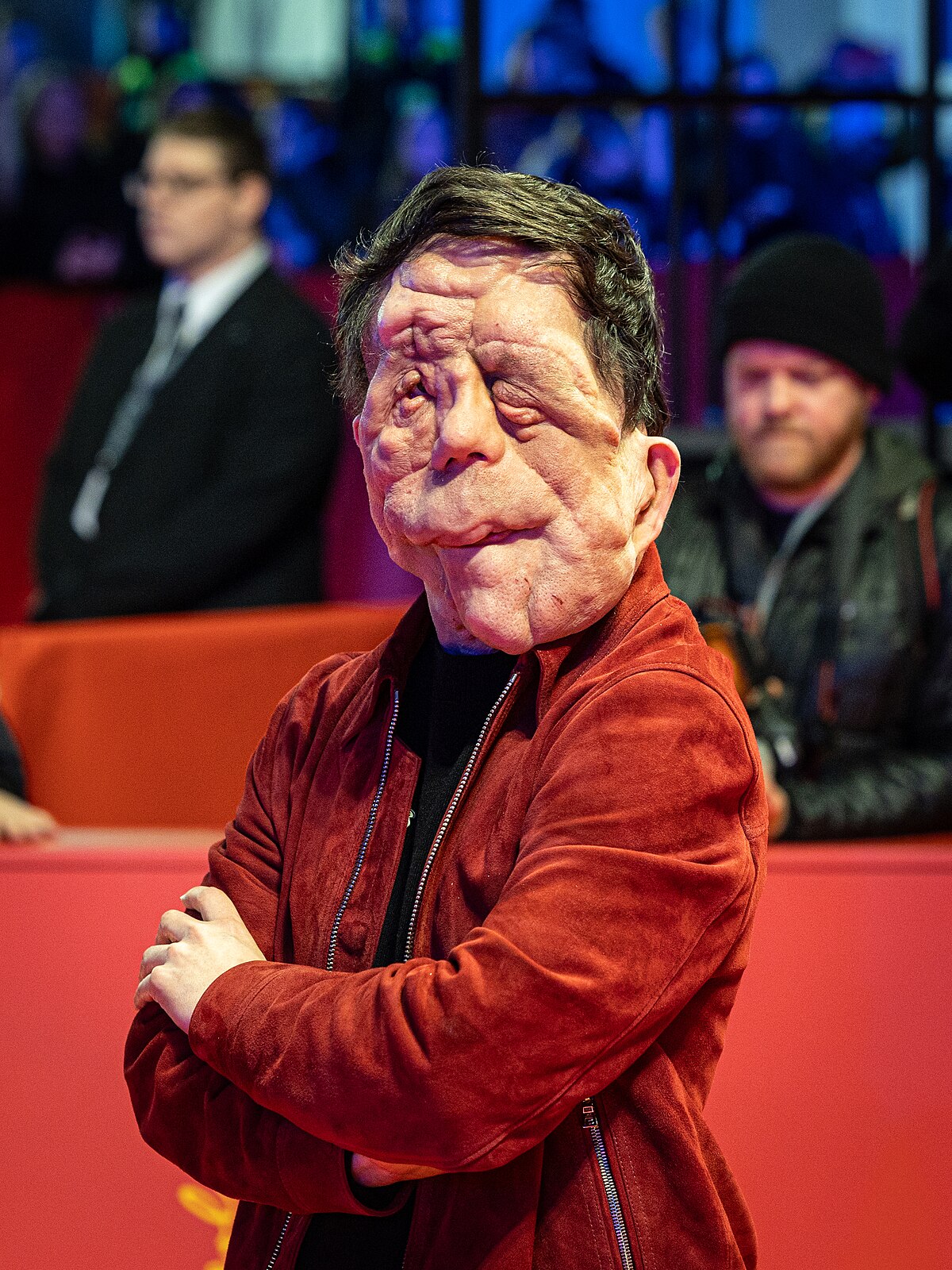 L&rsquo;Influence d&rsquo;Adam Pearson dans le Cinéma et VIH/Handicap