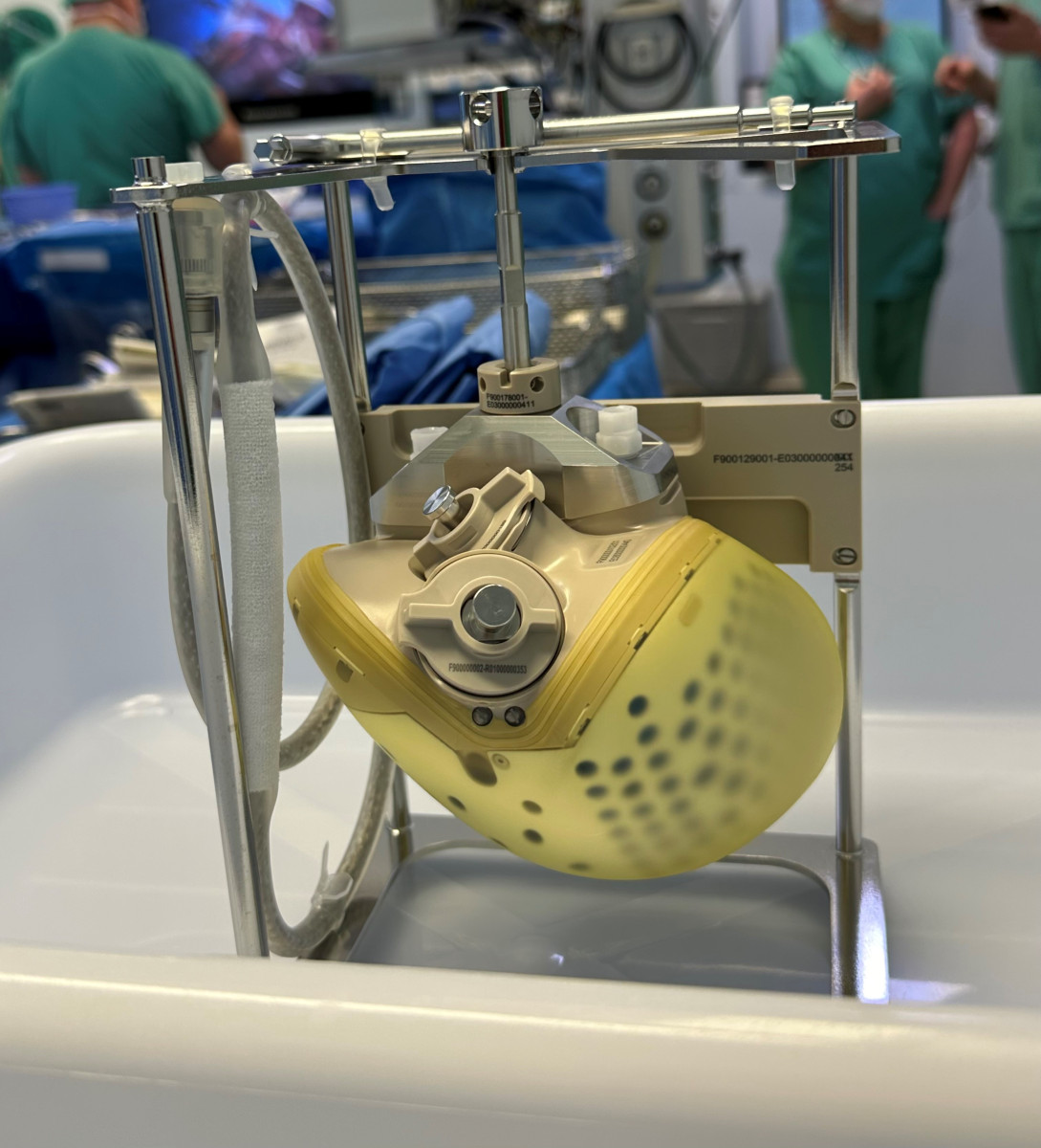 CARMAT : Une Révolution dans le Traitement des Maladies Cardiaques