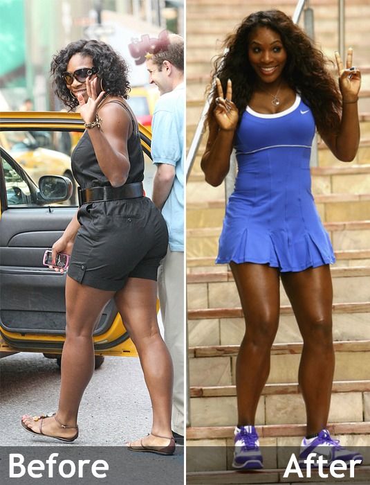 Serena Williams : Icone Tennis et Entrepreneuse