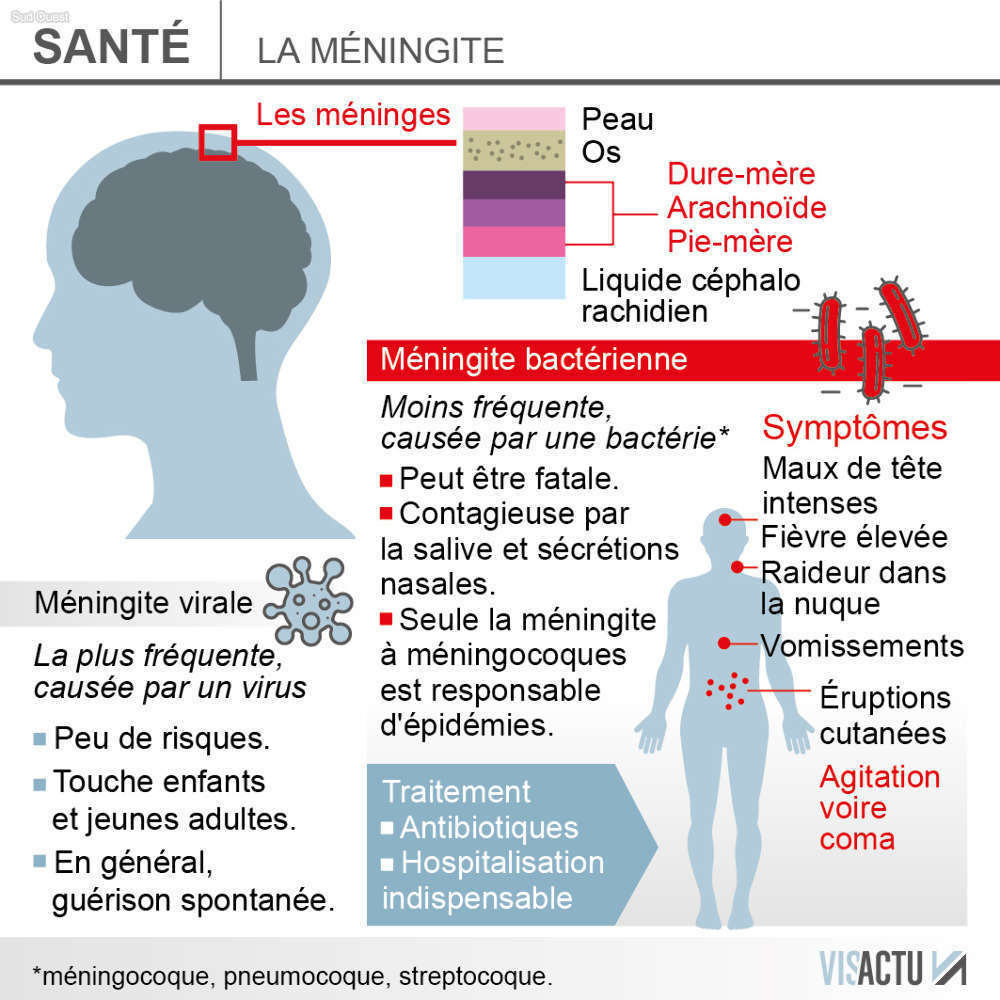 Épidémie de méningite B : que savoir et quelles mesures prendre ?